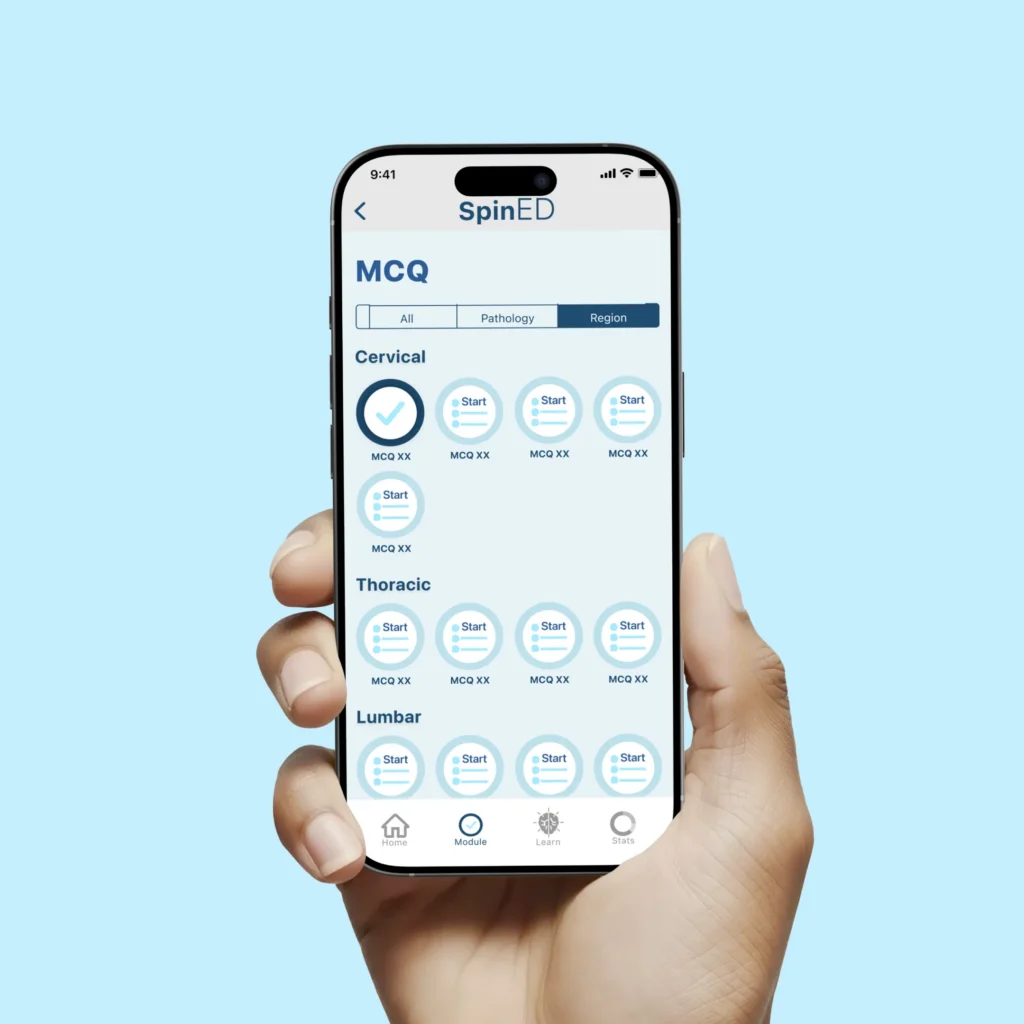 Hand holding a smartphone showing SpinED multiple choice quizzes sorted by cervical, thoracic and lumbar regions